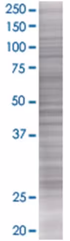Rab32 293t cell transient overexpre ssion lysate (denatured) 100 µl