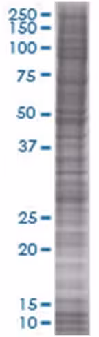 Rbpms 293t cell transient overexpre ssion lysate (denatured) 100 µl