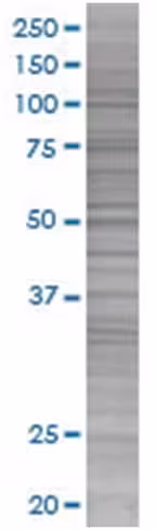 Pim2 293t cell transient overexpres sion lysate (denatured) 100 µl