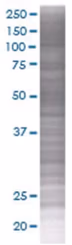 Polg2 293t cell transient overexpre ssion lysate (denatured) 100 µl