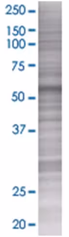 Pnkp 293t cell transient overexpres sion lysate (denatured) 100 µl