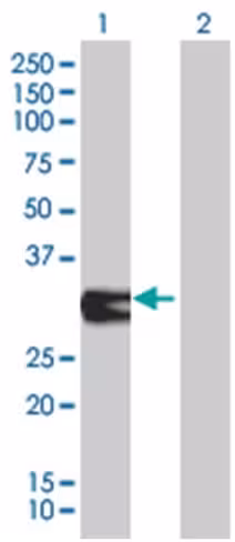Orc6l 293t cell transient overexpre ssion lysate (denatured) 100 µl