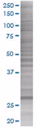 Orc6l 293t cell transient overexpre ssion lysate (denatured) 100 µl