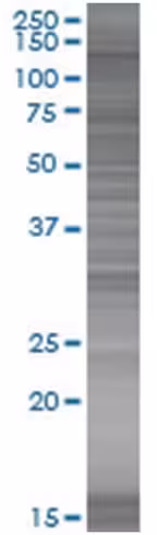 Rabgap1 293t cell transient overexp ression lysate (denatured) 100 µl
