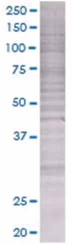 Rad54b 293t cell transient overexpr ession lysate (denatured) 100 µl
