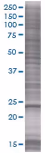 Rab26 293t cell transient overexpre ssion lysate (denatured) 100 µl