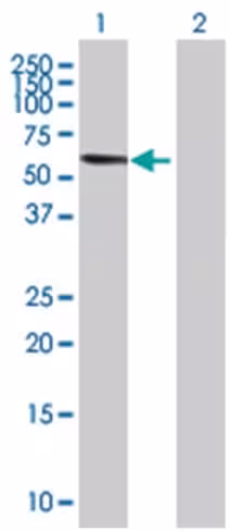 Phgdh 293t cell transient overexpre ssion lysate (denatured) 100 µl
