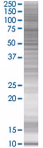 Oxgr1 293t cell transient overexpre ssion lysate (denatured) 100 µl