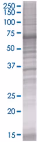 Pdlim3 293t cell transient overexpr ession lysate (denatured) 100 µl