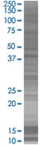 Pclo 293t cell transient overexpres sion lysate (denatured) 100 µl