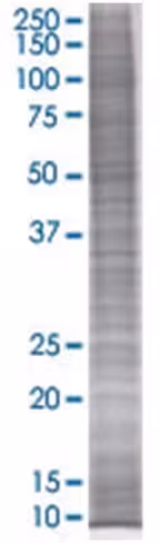 Pr48 293t cell transient overexpres sion lysate (denatured) 100 µl