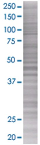 Ppp2r3b 293t cell transient overexp ression lysate (denatured) 100 µl