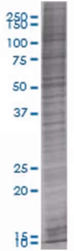 Asc 293t cell transient overexpress ion lysate (denatured) 100 µl