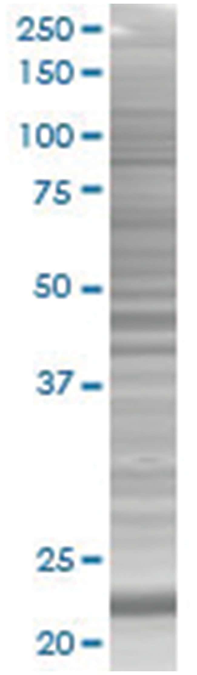 Pycard 293t cell transient overexpr ession lysate (denatured) 100 µl