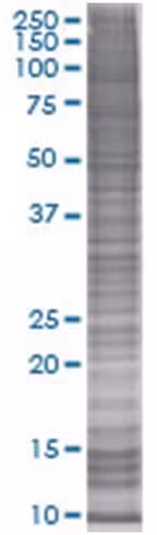 Pilrb 293t cell transient overexpre ssion lysate (denatured) 100 µl