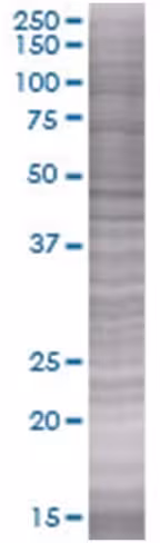 Pard6a 293t cell transient overexpr ession lysate (denatured) 100 µl