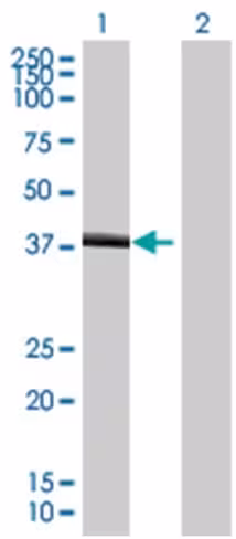 Phf11 293t cell transient overexpre ssion lysate (denatured) 100 µl