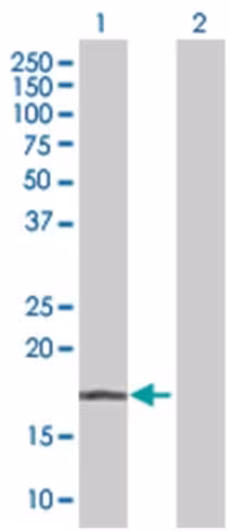 Pacap 293t cell transient overexpre ssion lysate (denatured) 100 µl