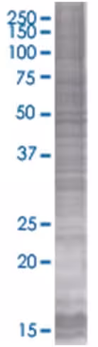 Rasl12 293t cell transient overexpr ession lysate (denatured) 100 µl
