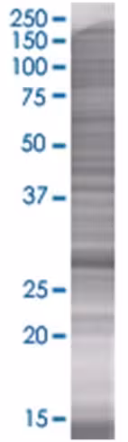 Rasl12 293t cell transient overexpr ession lysate (denatured) 100 µl