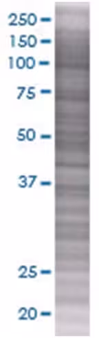 Prkag2 293t cell transient overexpr ession lysate (denatured) 100 µl