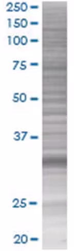 Prrx2 293t cell transient overexpre ssion lysate (denatured) 100 µl