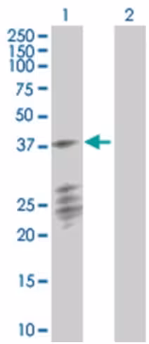 Ptplad1 293t cell transient overexp ression lysate (denatured) 100 µl