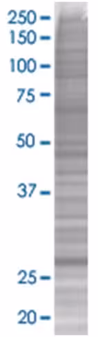 Rab23 293t cell transient overexpre ssion lysate (denatured) 100 µl