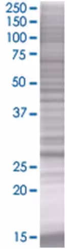 Rab20 293t cell transient overexpre ssion lysate (denatured) 100 µl