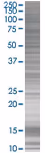 Pard3 293t cell transient overexpre ssion lysate (denatured) 100 µl