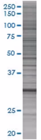 Plscr3 293t cell transient overexpr ession lysate (denatured) 100 µl