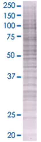 Pnpla2 293t cell transient overexpr ession lysate (denatured) 100 µl
