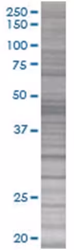 Plxdc1 293t cell transient overexpr ession lysate (denatured) 100 µl