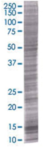Rab22a 293t cell transient overexpr ession lysate (denatured) 100 µl