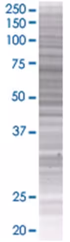 Pogk 293t cell transient overexpres sion lysate (denatured) 100 µl