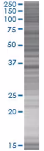 Ovol2 293t cell transient overexpre ssion lysate (denatured) 100 µl