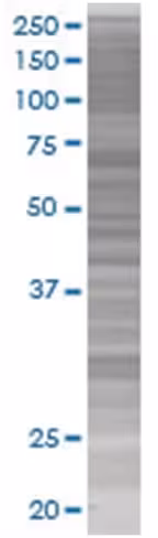 Rbm15 293t cell transient overexpre ssion lysate (denatured) 100 µl