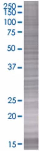 Rasl11b 293t cell transient overexp ression lysate (denatured) 100 µl