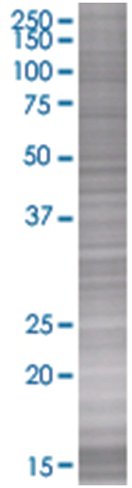 Rasl11b 293t cell transient overexp ression lysate (denatured) 100 µl