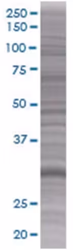 Rassf5 293t cell transient overexpr ession lysate (denatured) 100 µl