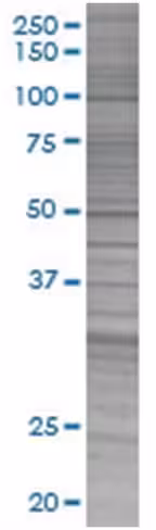 Ppp1r1b 293t cell transient overexp ression lysate (denatured) 100 µl