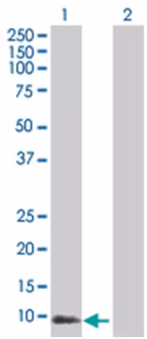 Prok1 293t cell transient overexpre ssion lysate (denatured) 100 µl