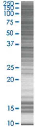 Pepp-2 293t cell transient overexpr ession lysate (denatured) 100 µl