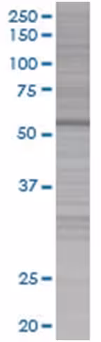 Phacs 293t cell transient overexpre ssion lysate (denatured) 100 µl