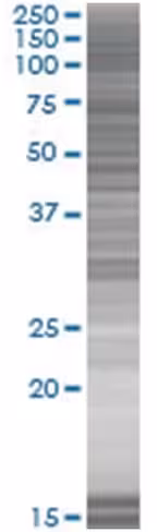 Pygo2 293t cell transient overexpre ssion lysate (denatured) 100 µl