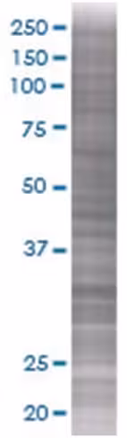 Ny-sar-48 293t cell transient overe xpression lysate (denatured) 100 µl