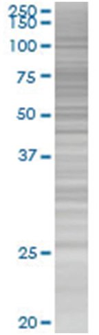 Nxnl1 293t cell transient overexpre ssion lysate (denatured) 100 µl