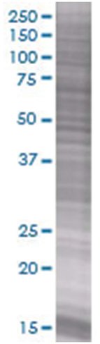 Art5 293t cell transient overexpres sion lysate (denatured) 100 µl