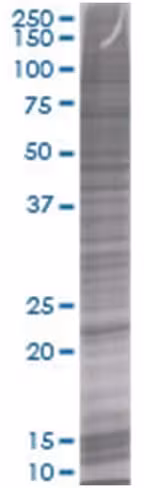 Asb6 293t cell transient overexpres sion lysate (denatured) 100 µl