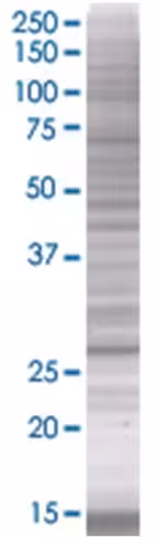 Asb7 293t cell transient overexpres sion lysate (denatured) 100 µl